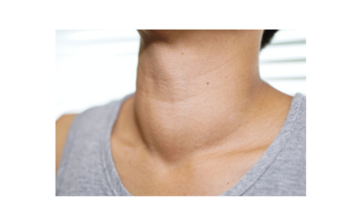 How Thyroid Can Be Detected? Is It Easy To Cure